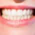 Is It Safe to Get Dental Implants in Costa Rica